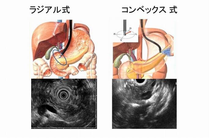 EUSの見え方