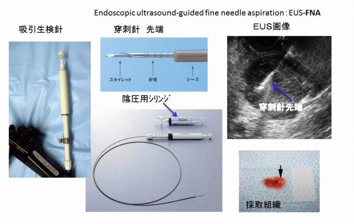 EUS－FNA