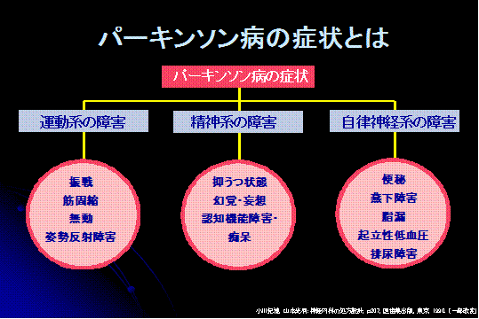 パーキンソン病の症状とは