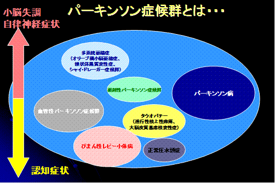 パーキンソン症候群とは